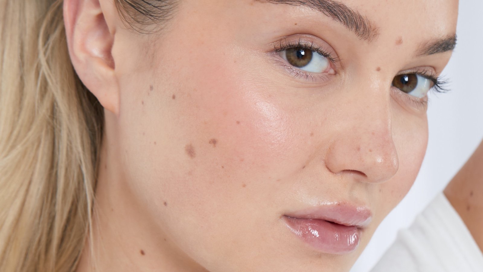 Skin Whitening Treatment Dubai: Laser, Creams & Serums